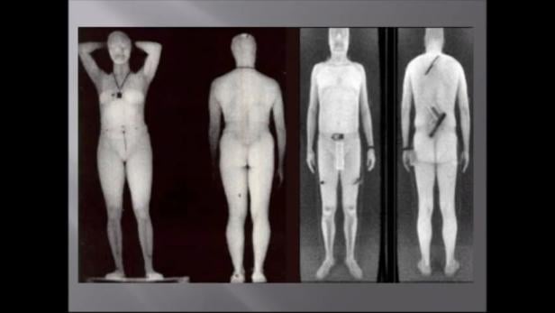 Bodyscanner