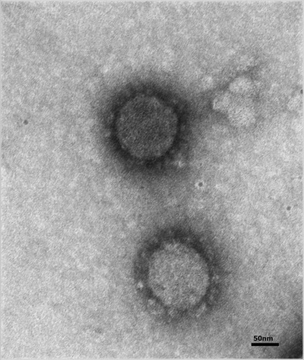 ++ HANDOUT ++ CORONAVIRUS: COVID-19 (SARS-COV-2)-ERREGER