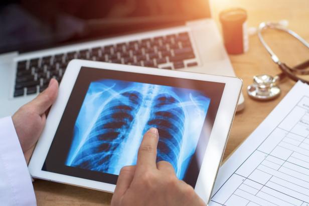 Doctor shows results to old patient x-ray of the lungs, smoking cigarettes problem