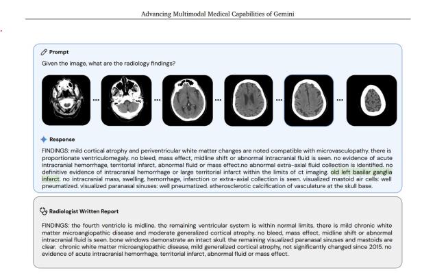 Screenshot aus dem Fachartikel mit mehreren Gehirnscans.