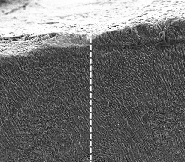 Vergleich der Zähne vor und nach der Behandlung mit Keratin.