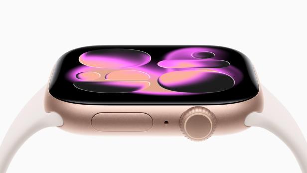 Apple Watch Series 11