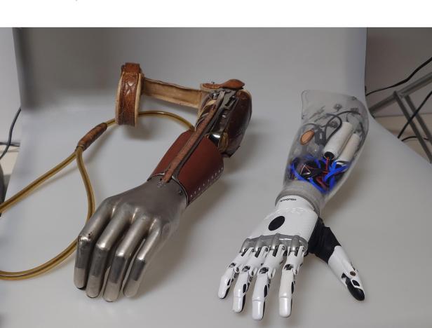 eine historische Blech-Handprothese, daneben eine elektronische Prothese aus Kunststoff