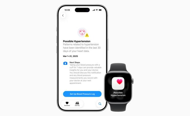 Ein iPhone und eine Apple Watch