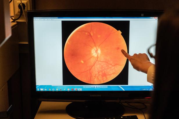 Universitätsklinik für Augenheilkunde und Optometrie