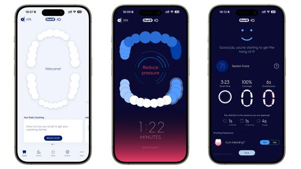 In der Smartphone-App der Oral-B iO Series 10 wird die Position der Zahnbürste, der Andruck, die Putzzeit sowie der Live-Coach und ein Zahnputzprotokoll dargestellt.