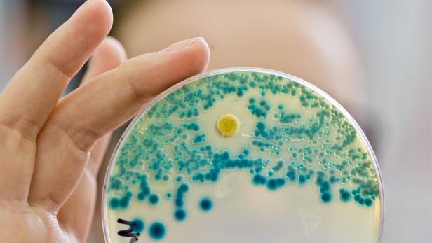 Nachweis von resistenten Bakterien auf einer Kulturplatte.