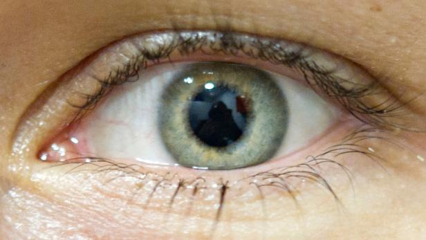 Zeig mir deine Augen und ich sag‘ dir, was du hast. Zumindest manche Krankheiten können über die Augen festgestellt werden. Forscher des Gladstone Institute und der University of California fanden nun heraus, dass eine Verdünnung der Netzhaut ein frühes Zeichen der sogenannten frontotemporalen Demenz, auch Pick-Krankheit, sein kann.