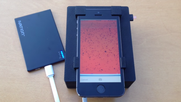 CellSope nutzt ein Smartphone für die Analyse von Blutproben