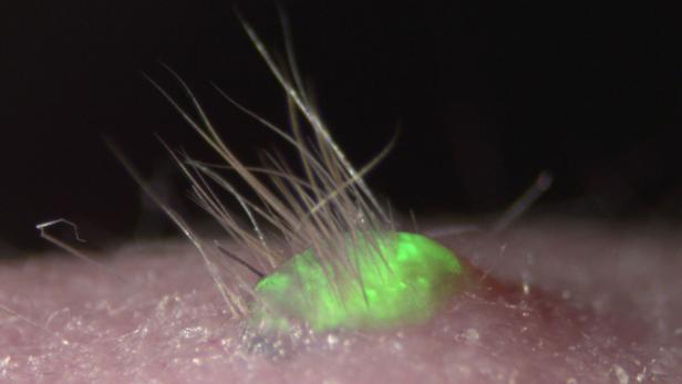 Das Hautstück mit Haaren - die Fluoreszenz dient der Beobachtbarkeit