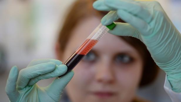 Das Land Kärnten will erst 2016 offiziell zu weiteren HCB-Bluttests aufrufen.