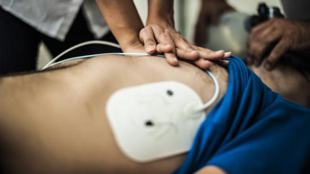 Defibrillatoren sind groß und unpraktisch, ein Grazer-Startup plant ein alternatives Gerät