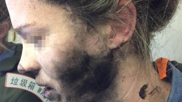Die Beats-Kopfhörerin einer Frau explodierten während eines Flugs - Apple will dafür keine Verantwortung übernehmen
