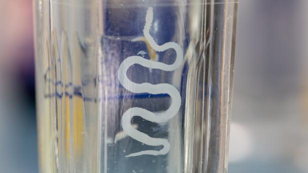 Tapeworm is a freshwater fish parasite under the microscope for education. Bandwurm