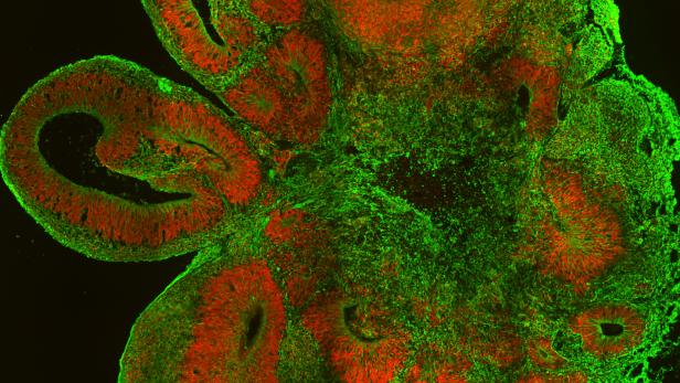 Ein Querschnitt durch ein Gehirn-Organoid : Neuronale Stammzellen in grün und Neuronen in rot