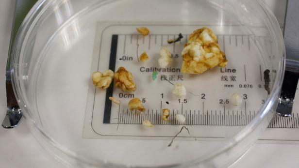 Microplastic found in some grey mullet examined by Greenpeace is displayed at a news conference in Hong Kong