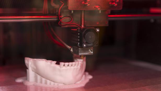 Maßgescheiderter Kieferknochen aus dem 3D-Drucker