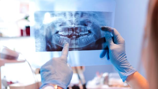 Close-up of female doctor pointing at teeth x-ray image at dental office.