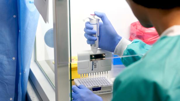 FILE PHOTO: RealTime Laboratories testing samples for the coronavirus disease (COVID-19) in Carrollton, Texas