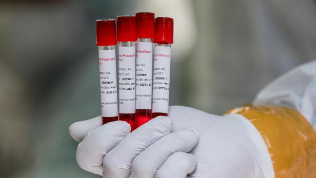 Swab tests amid coronavirus pandemic in Medan