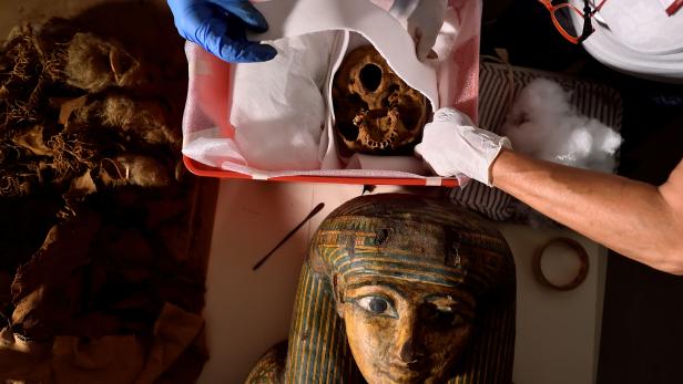 An Egyptian mummy is transferred from the Civic Archaeological Museum of Bergamo to Milan's Policlinico hospital to undergo a CT scan