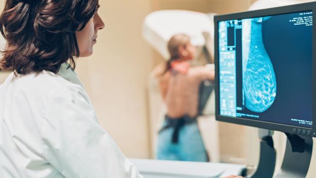 Als Mammographie bezeichnet man die Röntgenuntersuchung der Brust.