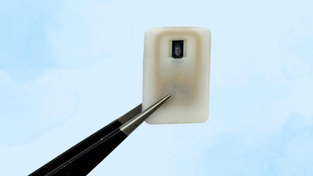 Das Implantat zur Glukagon-Abgabe Das Implantat zur Glukagon-Abgabe