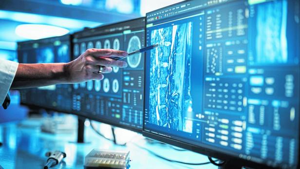 KI-Modelle können Krankheiten auf Gehirn-Scans erkennen, machen aber Fehler (Symbolbild).