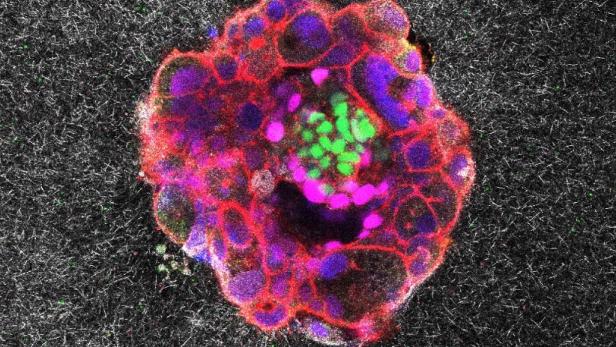 Koloriertes Bild eines Embryos.