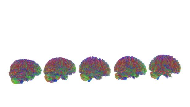 Illustration von 5 Gehirnen