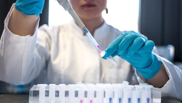 Eine Person im Labor pipettiert eine Flüssigkeit in ein Reagenzglas, umgeben von weiteren Probenröhrchen, was auf biotechnologische Forschung hinweist.