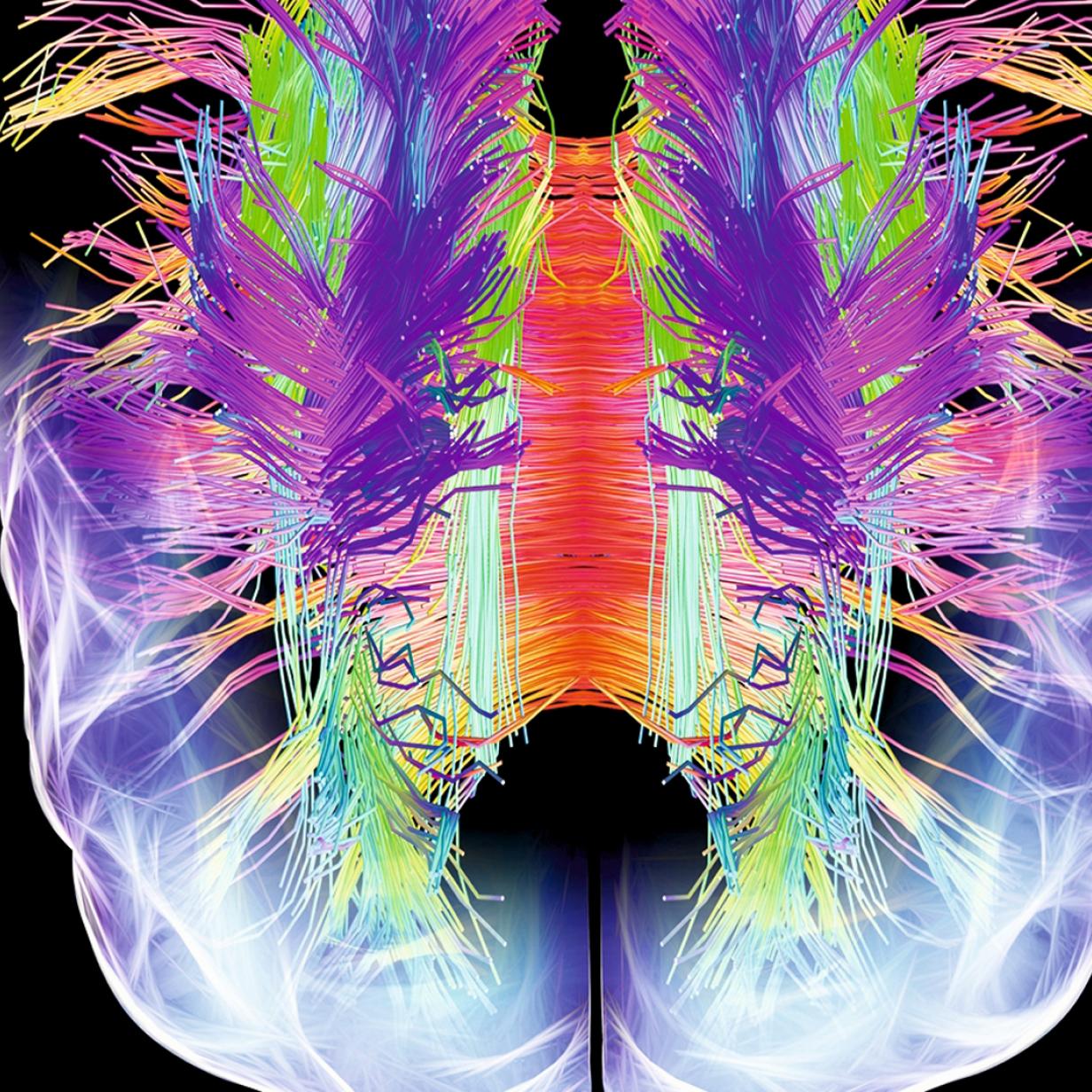 Hirnforschung Bewusstsein Zum Download