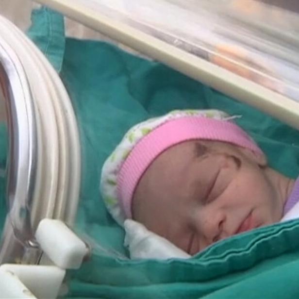 Ein schlafendes Baby liegt in einem Inkubator.