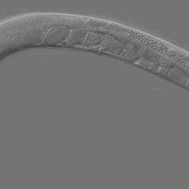 Ein Fadenwurm, möglicherweise Caenorhabditis elegans, unter dem Mikroskop betrachtet.