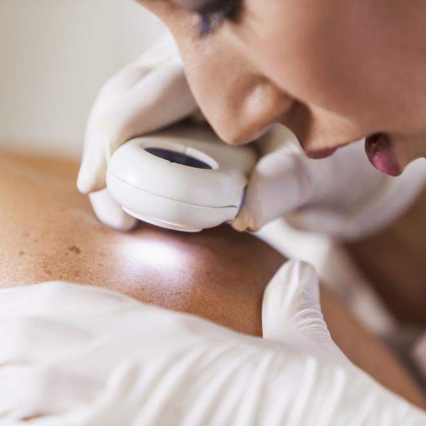 Dermatologist examining patient for signs of skin cancer