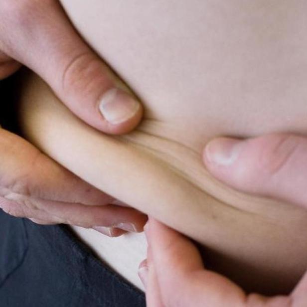 Bauchspeck lässt sich mit der richtigen Kleidung gut kaschieren