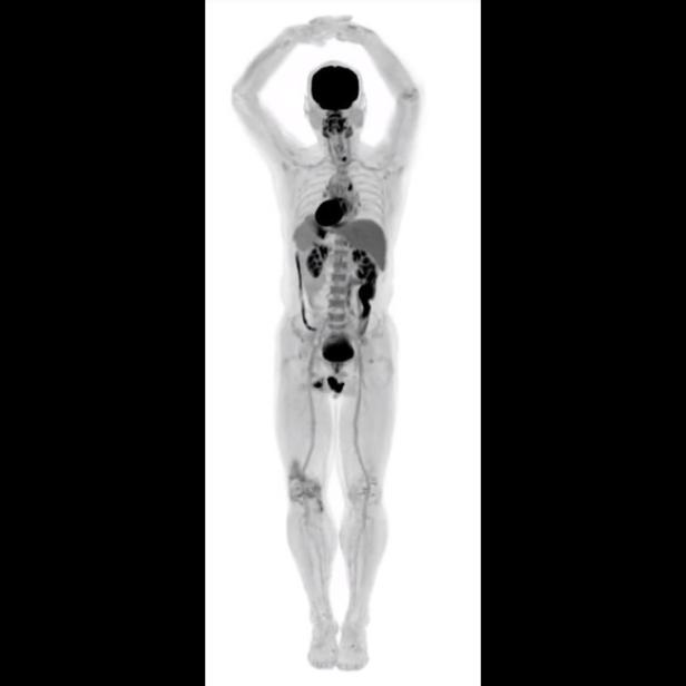 Ein Ganzkörperscan zeigt die inneren Organe einer Person mit erhobenen Armen.