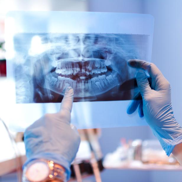 Close-up of female doctor pointing at teeth x-ray image at dental office.