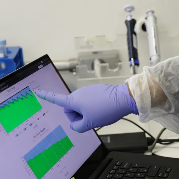 A scientist points to a computer screen showing a graphic of the coronavirus DNA sequencing at the Tropical Medicine Institute of the Sao Paulo University Medical School in Sao Paulo