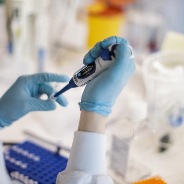 300 Antikörpertests sollen ab kommender Woche durchgeführt werden.