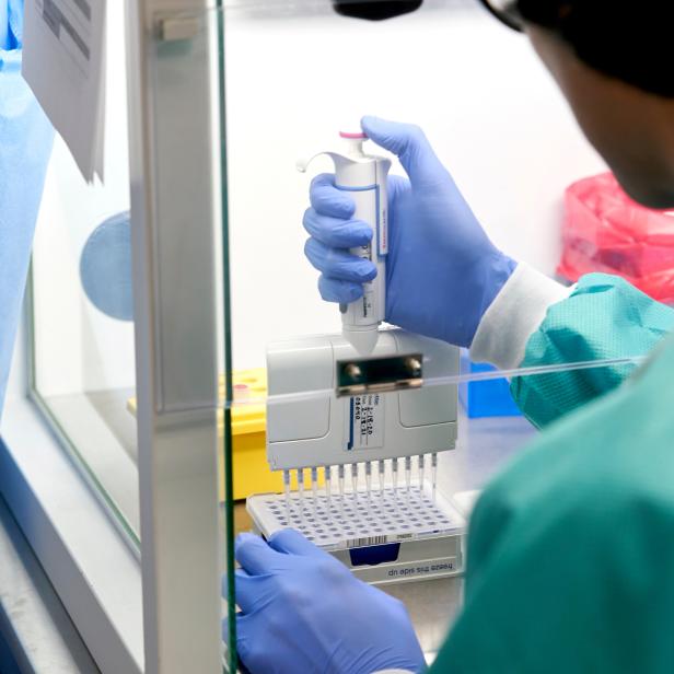 FILE PHOTO: RealTime Laboratories testing samples for the coronavirus disease (COVID-19) in Carrollton, Texas