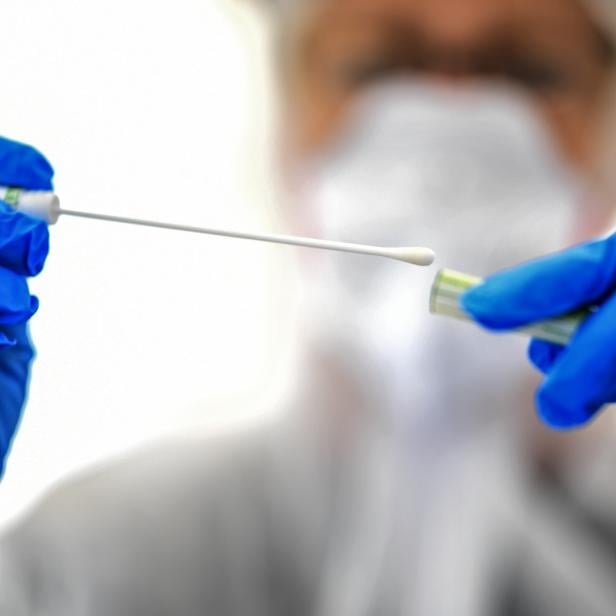 65.000 PCR-Abstriche können wöchentlich durchgeführt werden