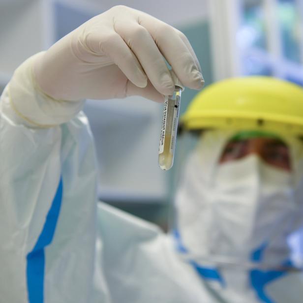 Hungarian university hospitals conduct mass coronavirus testing
