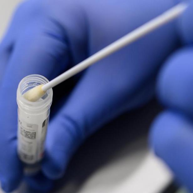 Eine Hand in einem blauen Handschuh führt einen Abstrich mit einem Wattestäbchen durch.