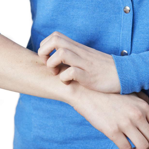 Close Up Of Woman Scratching Arm