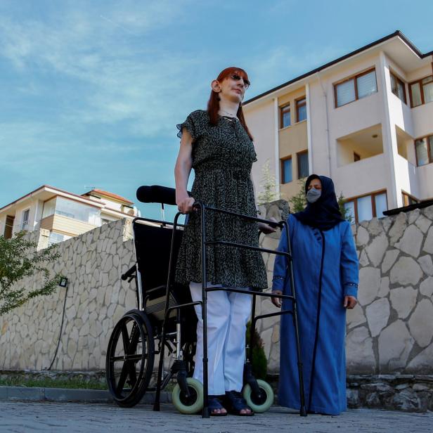 World's tallest woman Rumeysa Gelgi holds a news conference in Karabuk