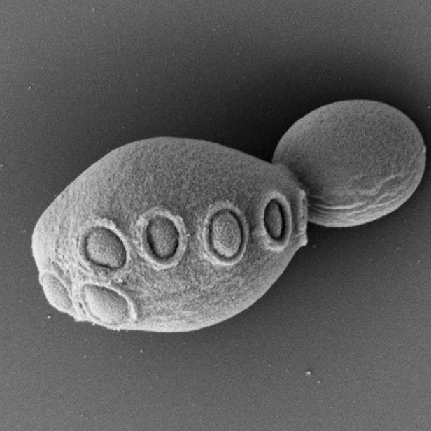 Hefezelle mit 31 Prozent synthetischer DNA