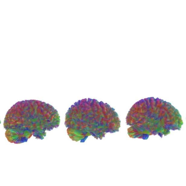 Illustration von 5 Gehirnen