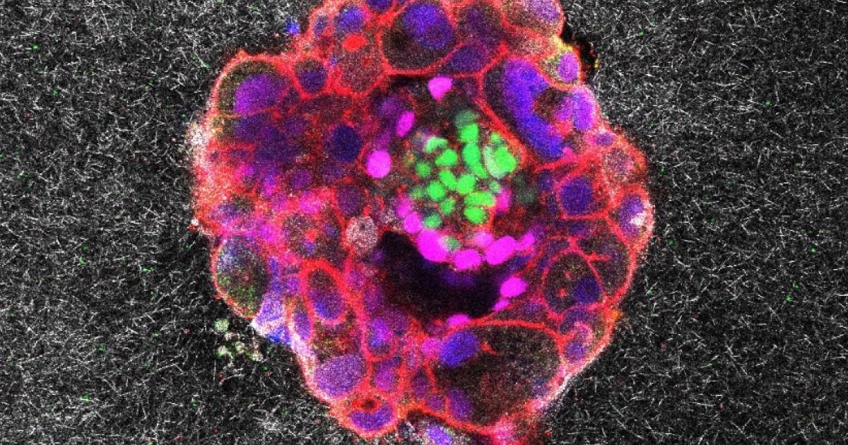 K-nstliche-Befruchtung-Erstmals-Embryo-Einnistung-gefilmt